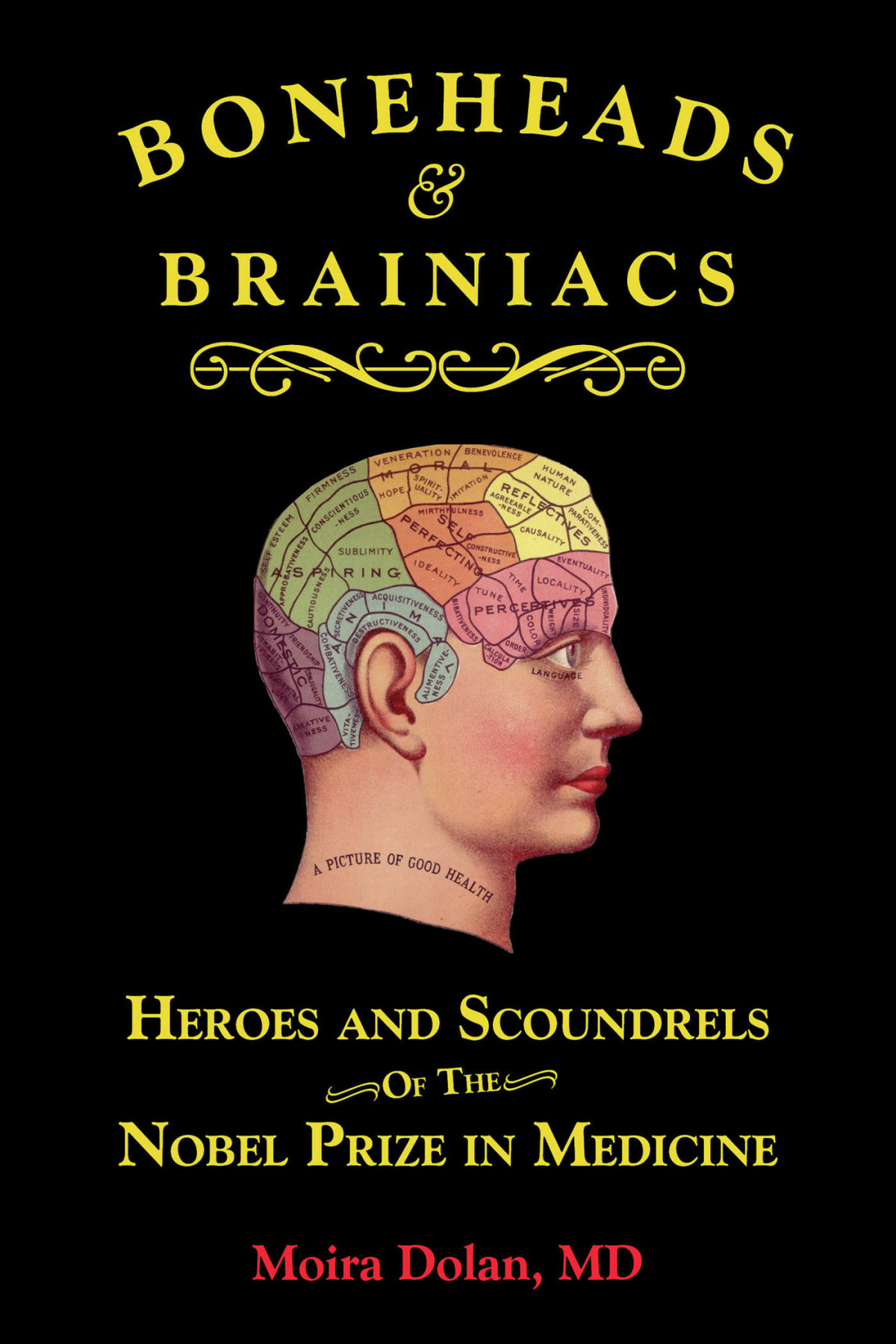 Boneheads Brainiacs Heroes And Scoundrels Of The Nobel Prize In Medicine Moira Dolan