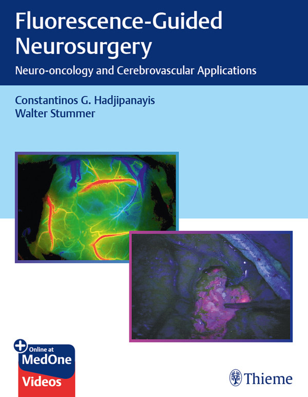 Fluorescenceguided Neurosurgery Hadjipanayis Constantinos G