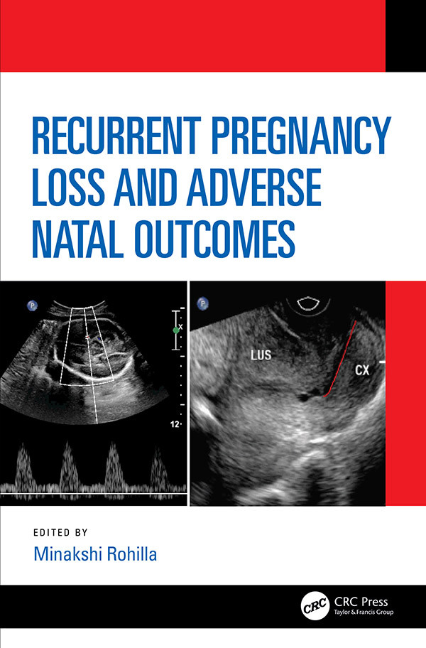 Recurrent Pregnancy Loss And Adverse Natal Outcomes Rohilla Minakshi