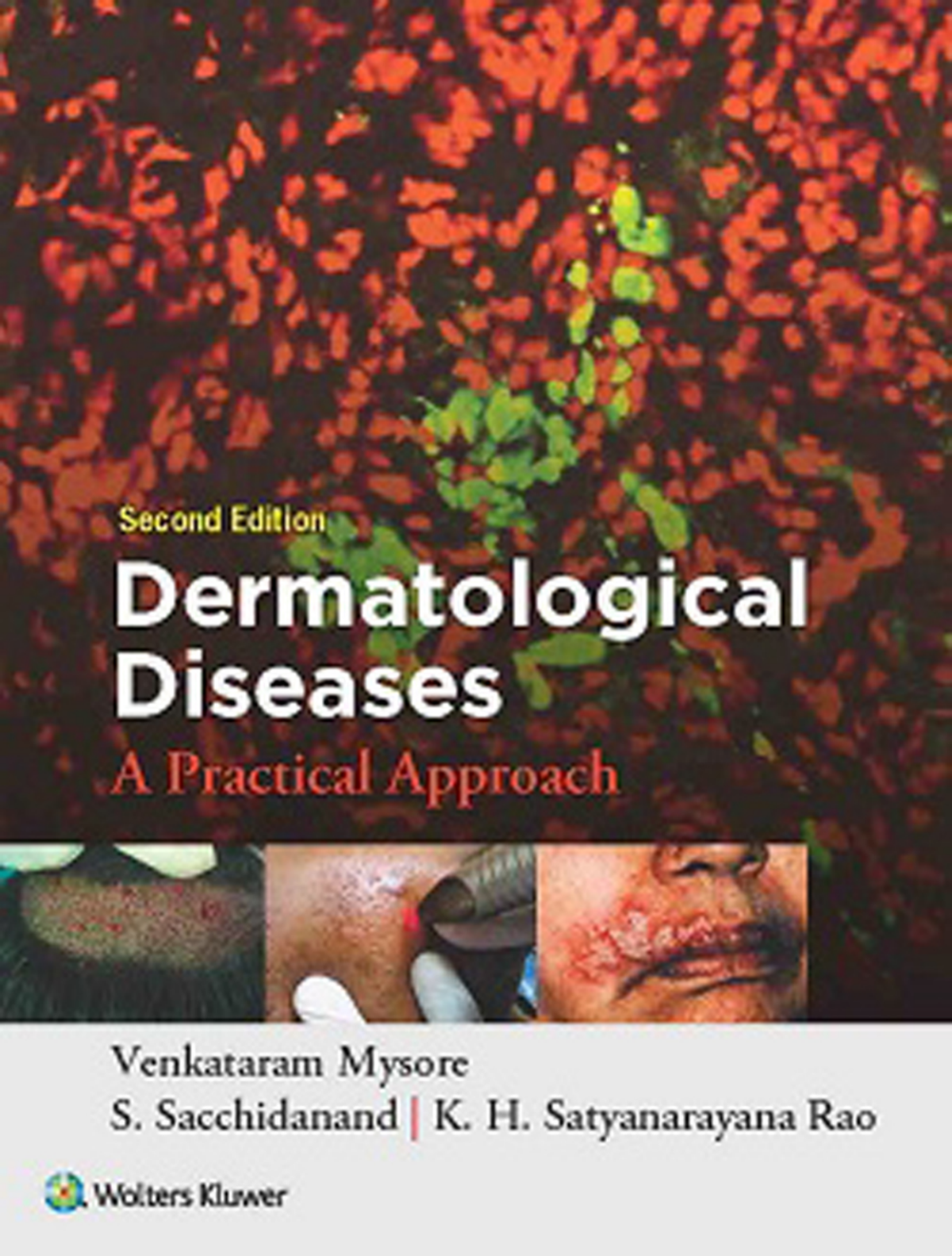 Dermatological Diseases A Practical Approach 2nd Edition Venkataram Mysore K H Satyanarayana Rao S Sacchidanand