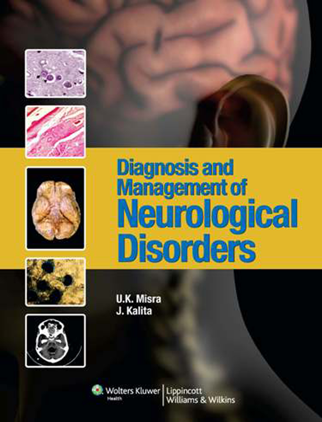 Diagnosis Management Of Neurological Disorders Misra