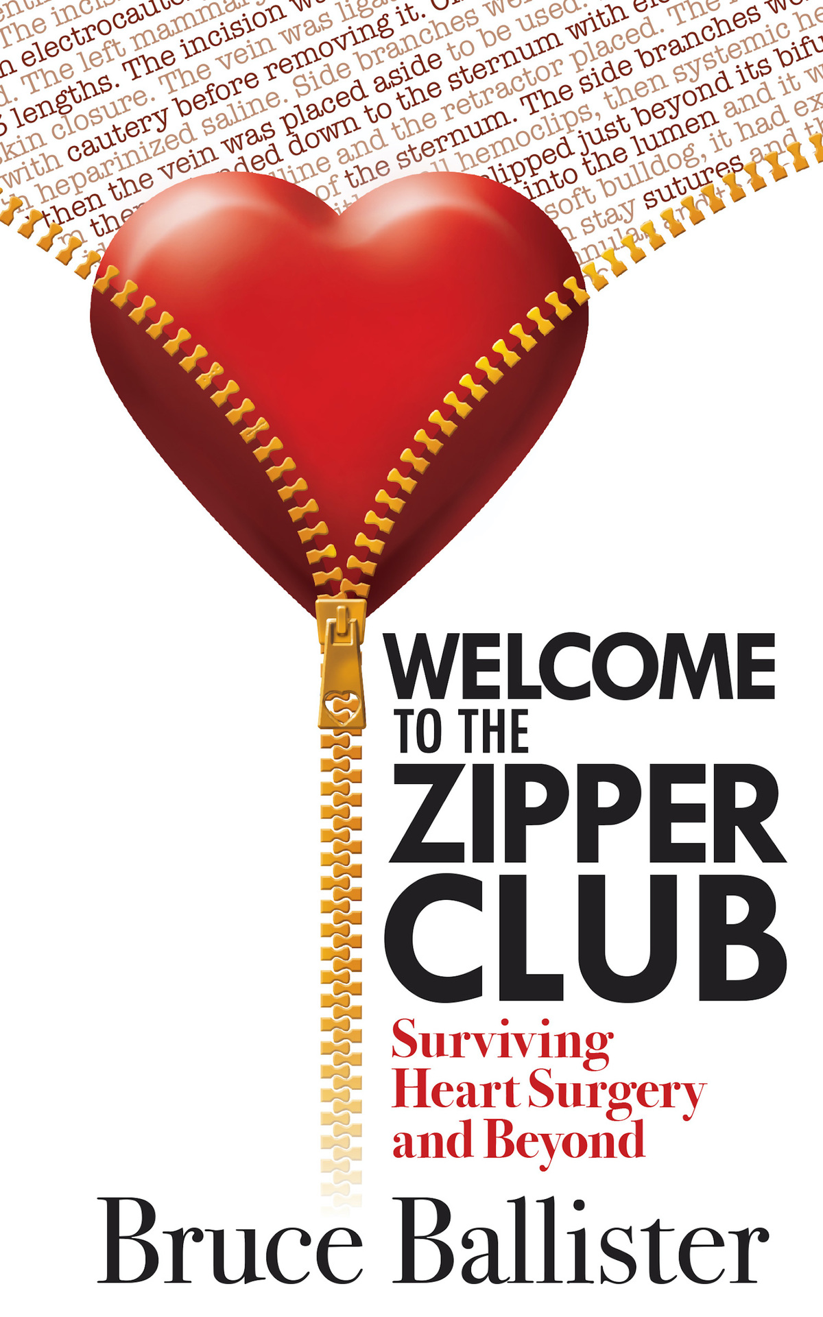 Welcome To The Zipper Club Surviving Heart Surgery And Beyond Ballister