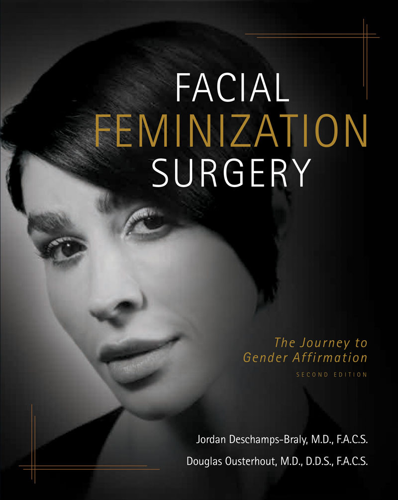 Facial Feminization Surgery Douglas K Ousterhout