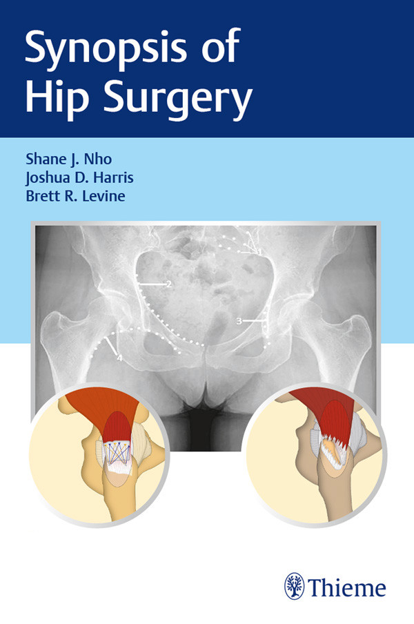 Synopsis Of Hip Surgery Shane J Nhojoshua D Harrisbrett R Levine