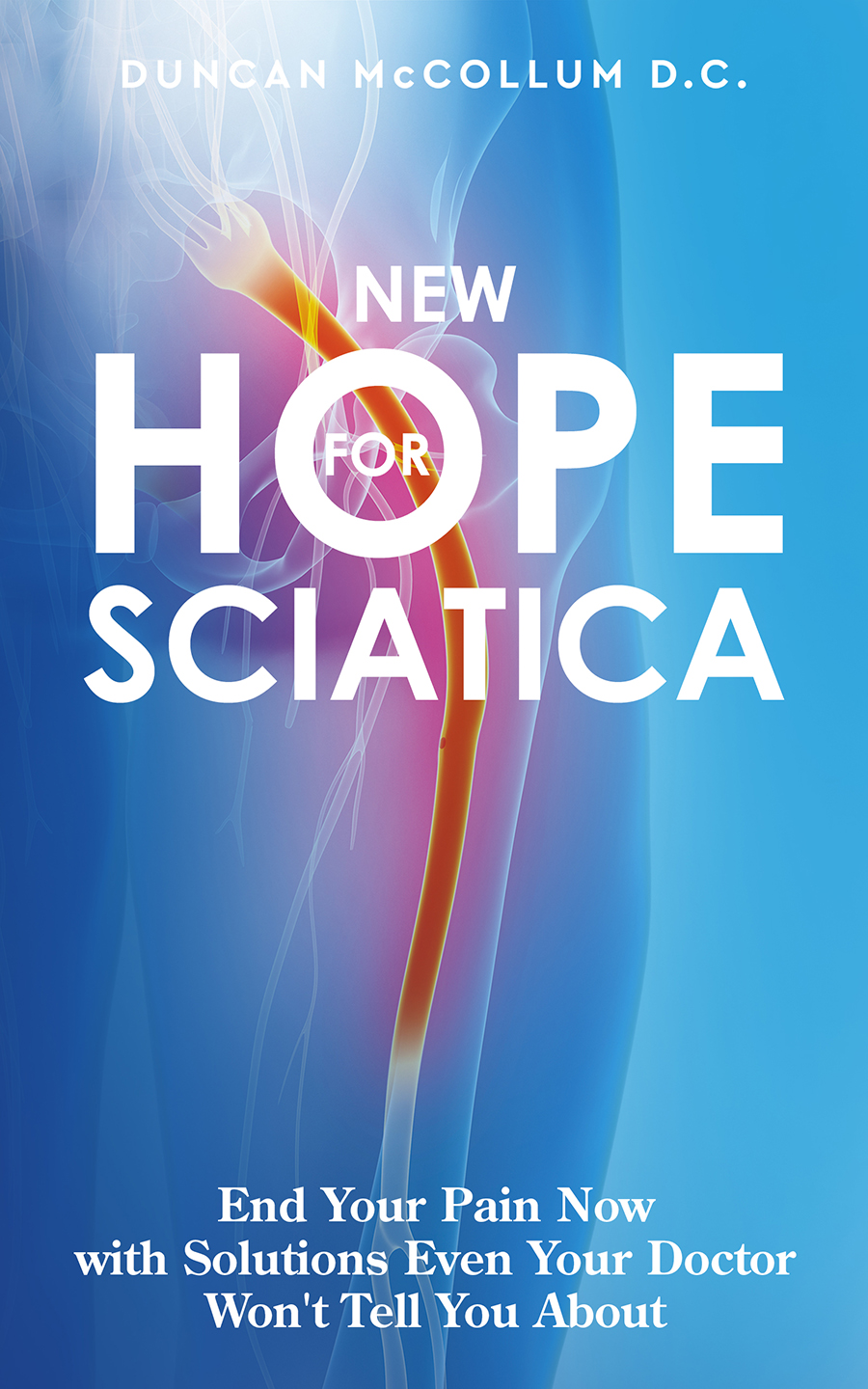 New Hope For Sciatica Dr Duncan Mccollum Dc