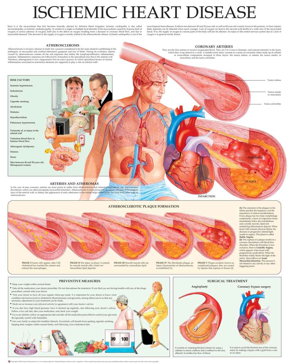 Ischemic Heart Disease Echart Hchealthcomm