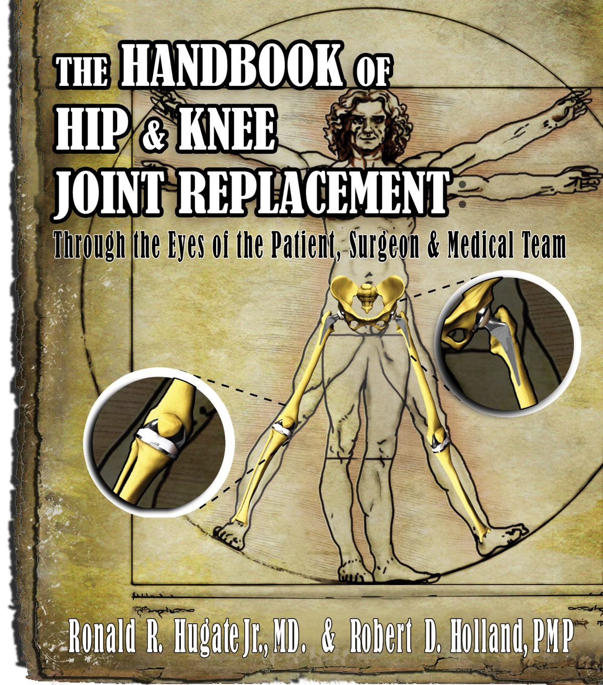 Handbook Of Hip Knee Joint Replacement Robert Holland
