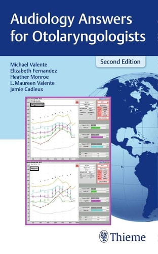 Audiology Answers For Otolaryngologists 2nd Edition Michael Valente
