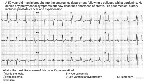 Passmedicine Mrcp Ii Ecg Practicepdf Passmedicine
