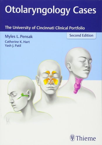 Otolaryngology Cases The University Of Cincinnati Clinical Portfolio 2e Oct 20 20179781626234192thiemepdf 2nd Edition Myles L Pensak