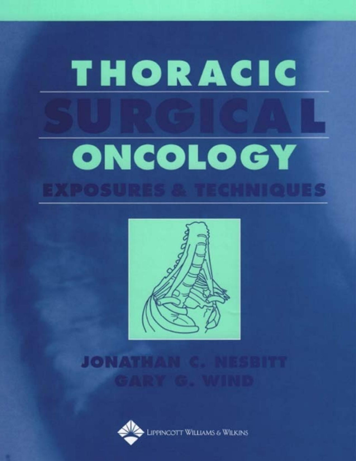Thoracic Surgical Oncology Exposures And Techniques Nesbitt
