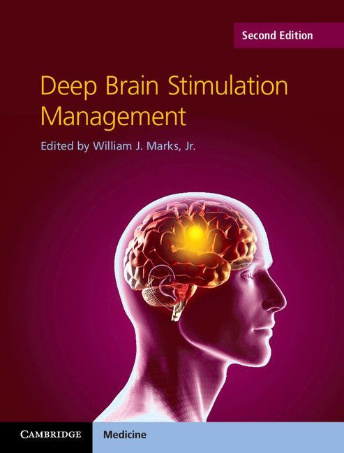 Deep Brain Stimulation Management Marks Jr William J