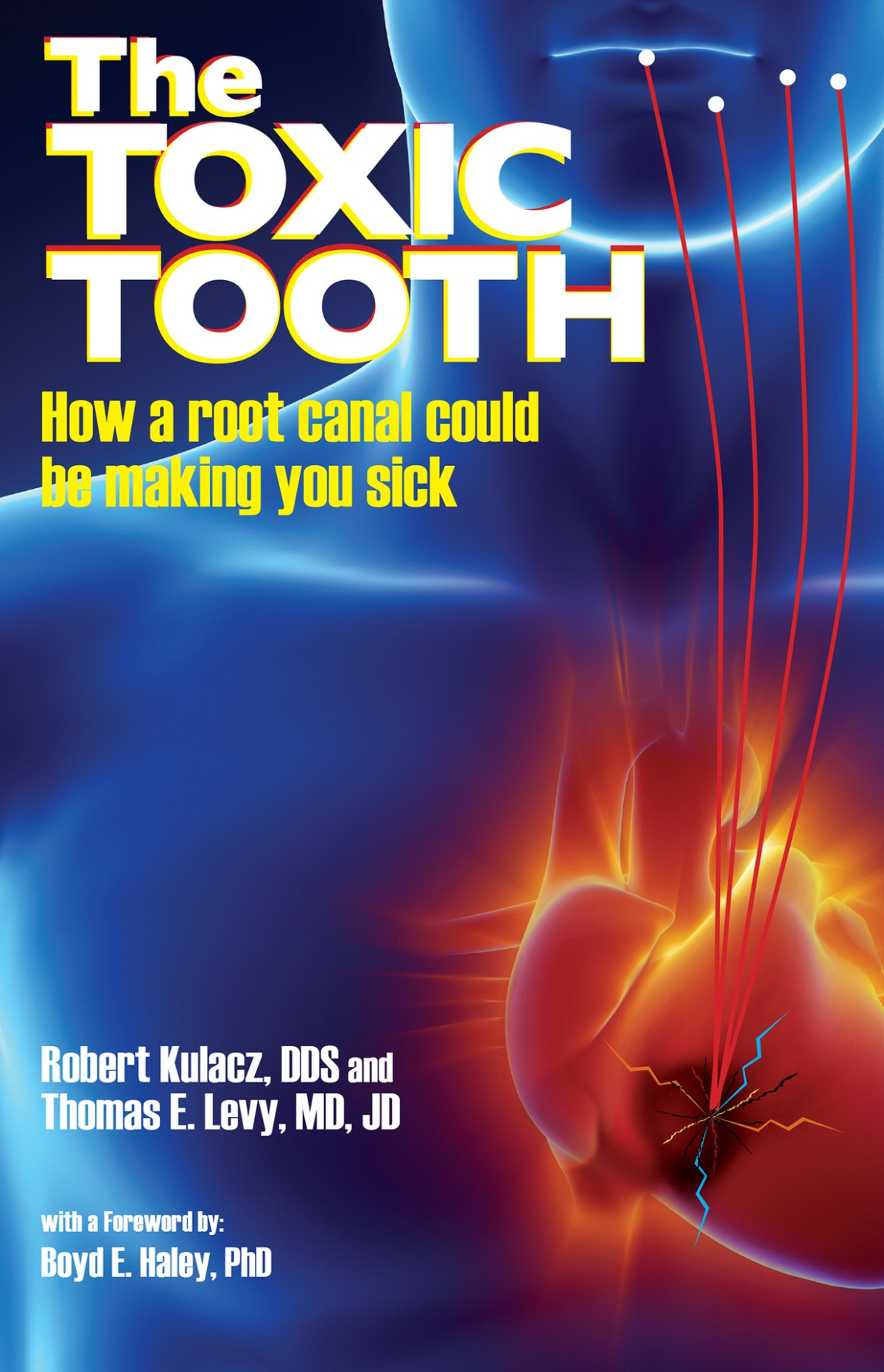 The Toxic Tooth How A Root Canal Could Be Making You Sick Dds Robert Kulacz Md Jd Levy