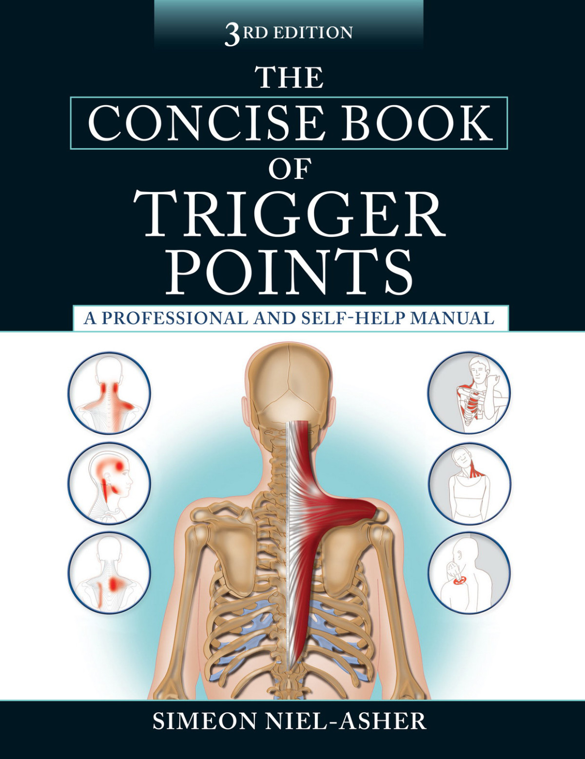 The Concise Book Of Trigger Points Simeon Nielasher
