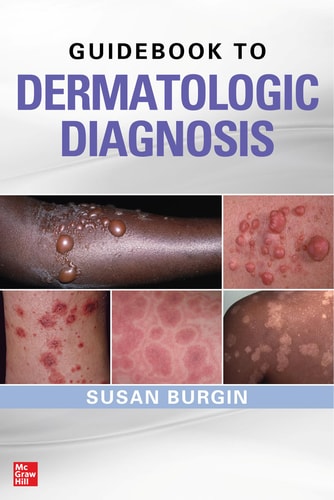 Guidebook To Dermatologic Diagnosis July 10 20200071738754mcgraw Hillepub 1st Edition Susan Burgin
