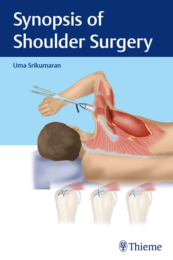 Synopsis Of Shoulder Surgery Uma Srikumaran