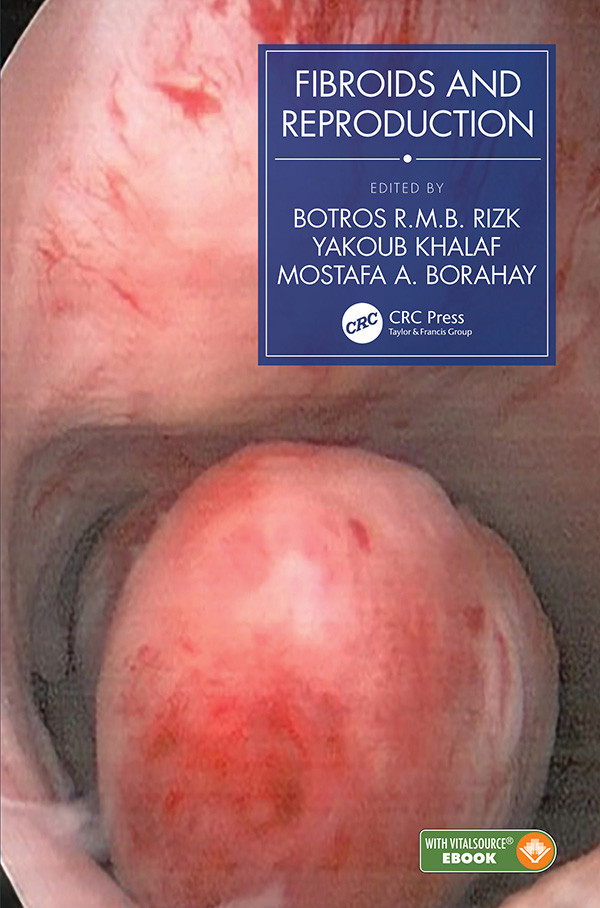 Fibroids And Reproduction Khalaf Yakoub Borahay Mostafa A Rizk