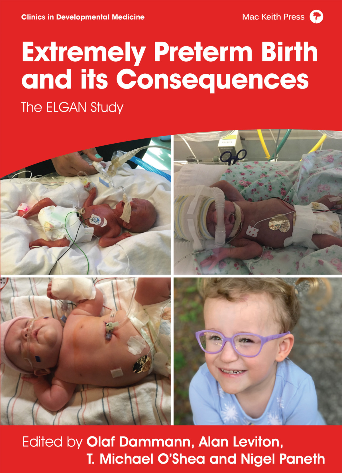 Extremely Preterm Birth And Its Consequences The Elgan Study Olaf Dammannalan Levitont Michael Osheanigel Paneth