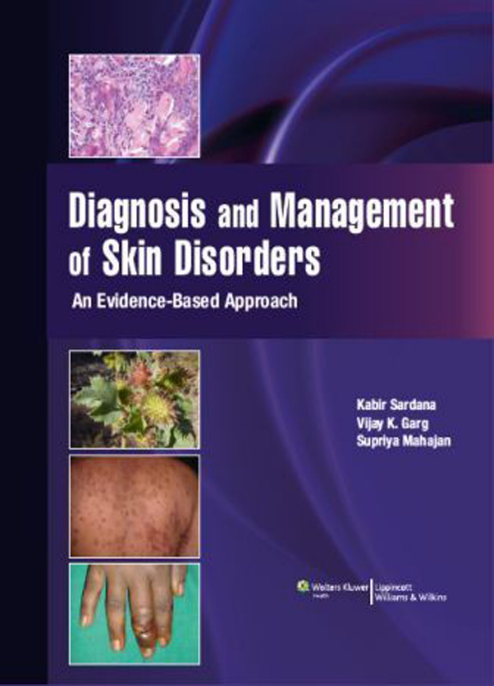 Diagnosis Management Of Skin Disorders 1st Edition Kabir Sardana Vijay K Garg Supriya Mahajan