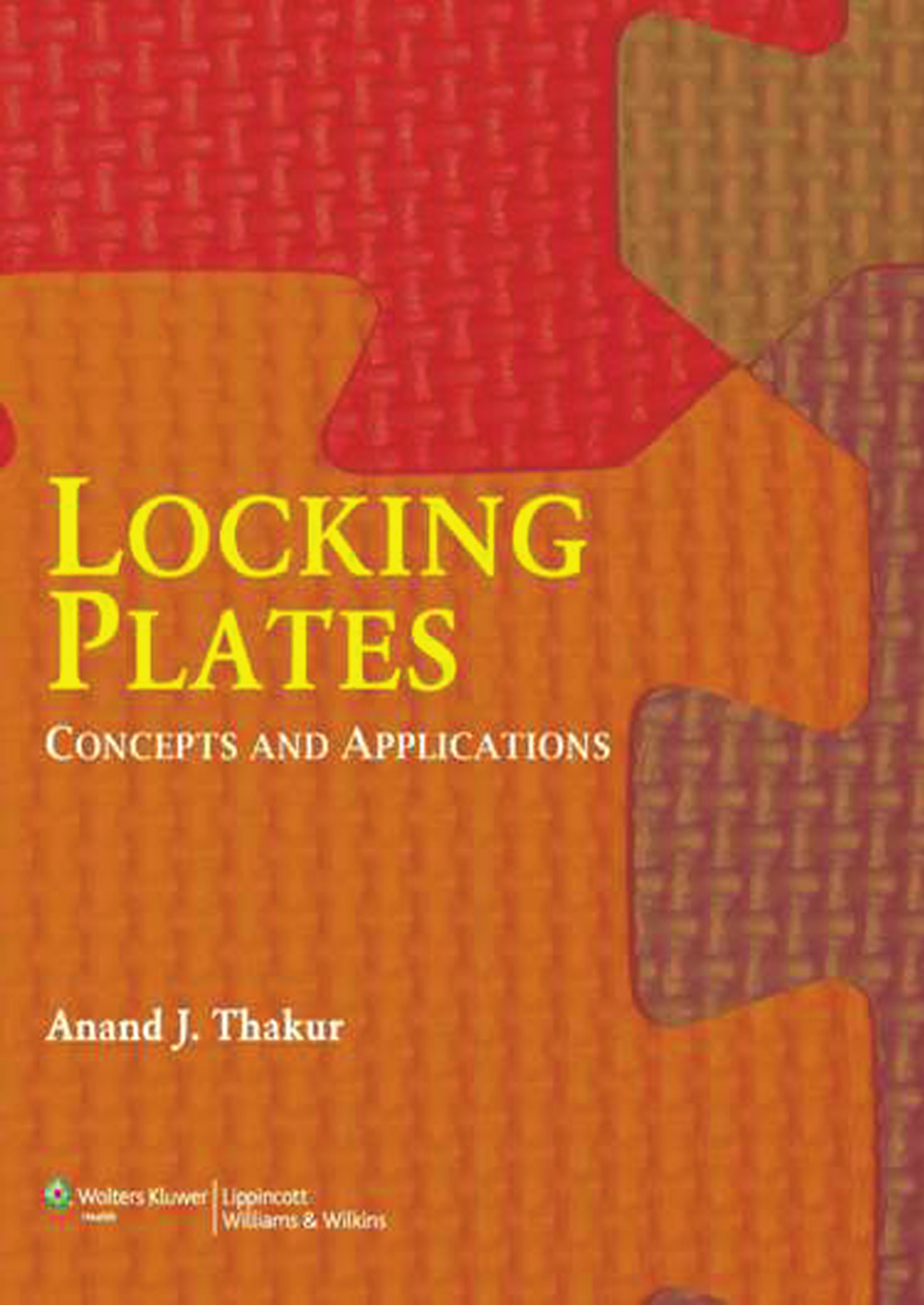 Locking Plates Concepts And Applications 2nd Edition Anand J Thakur