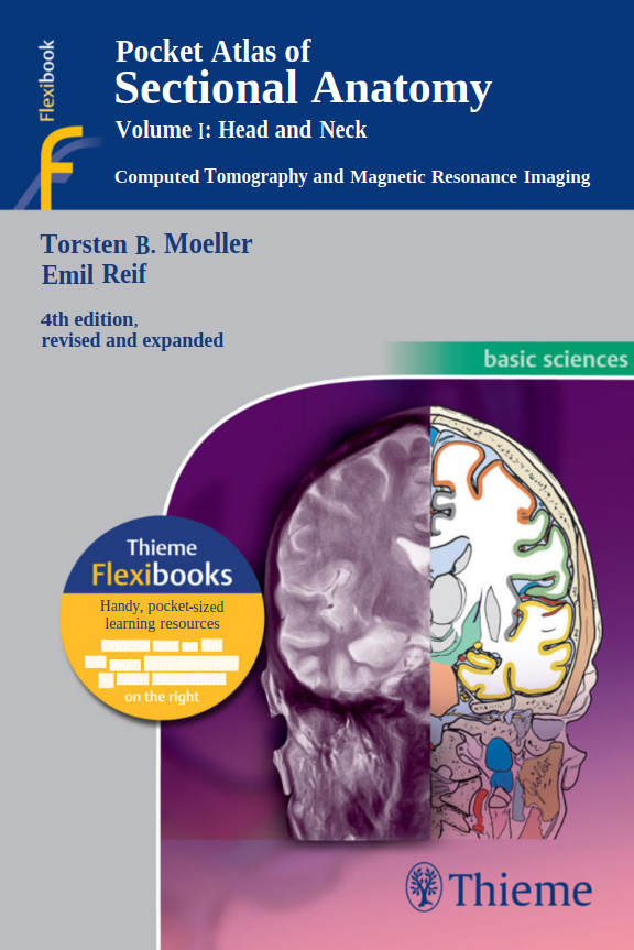 Pocket Atlas Of Sectional Anatomy Vol 1 Head And Neck Computed Tomography And Magnetic Resonance Imaging 4e Nov 5 20133131255048thiemepdf Torsten B Mller