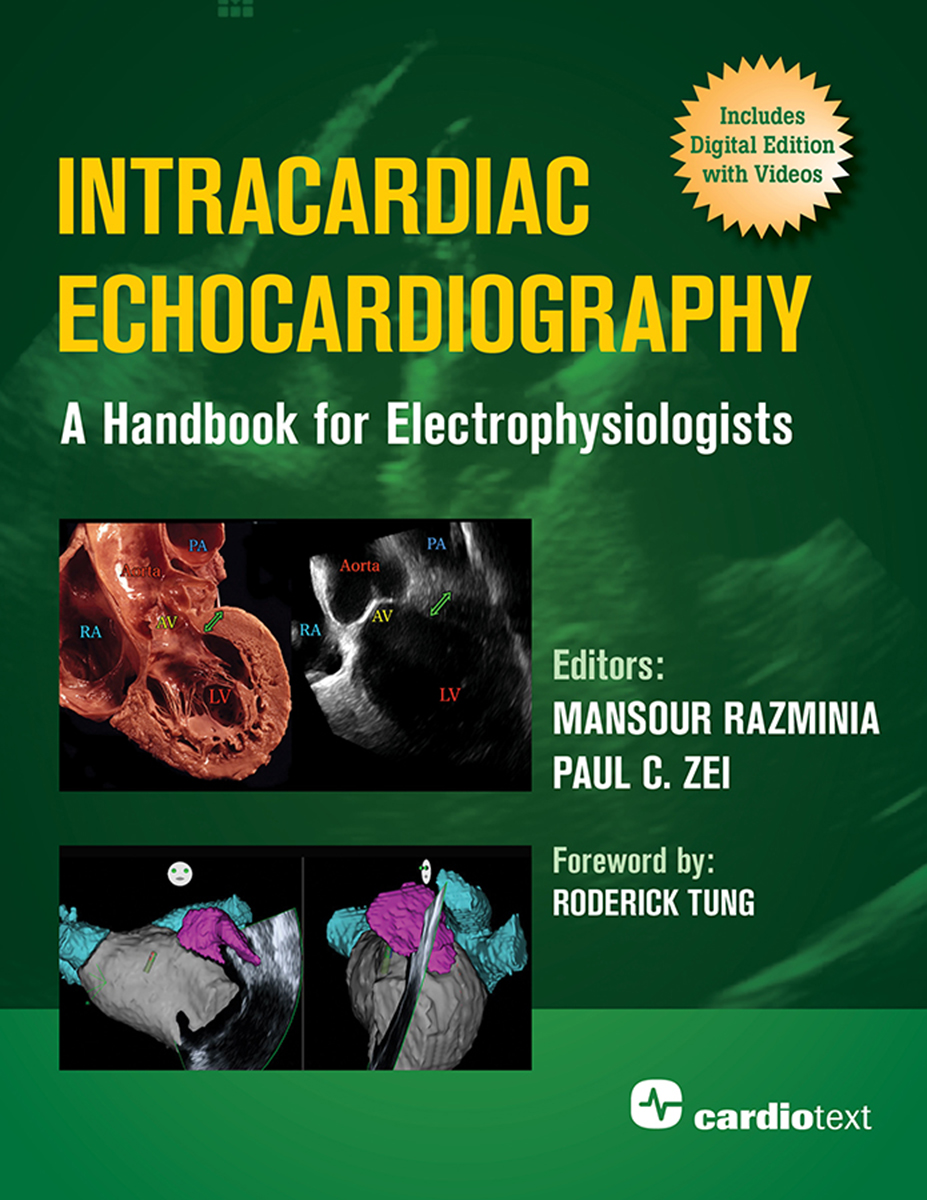 Intracardiac Echocardiography A Handbook For Electrophysiologists A Handbook For Electrophysiologists Mansour Razminia Paul C Zei