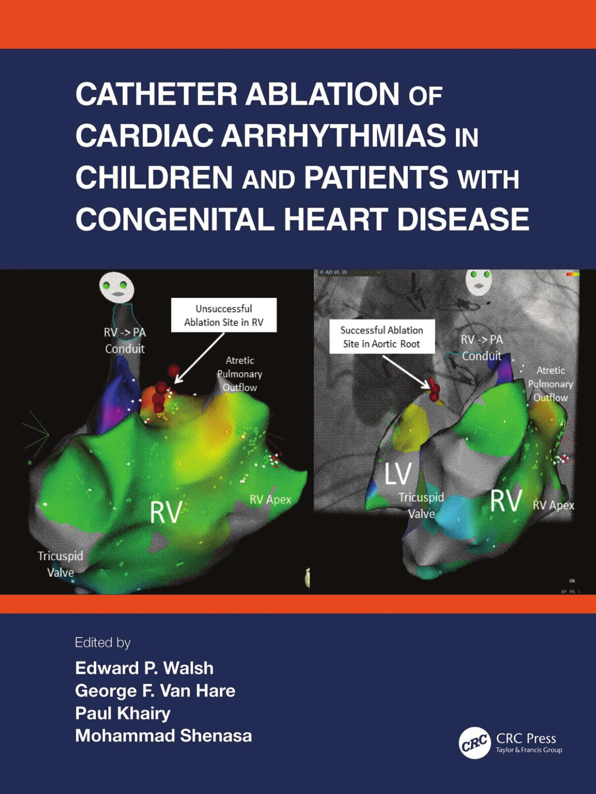 Catheter Ablation Of Cardiac Arrhythmias In Children And Patients With Congenital Heart Disease Edward P Walsh George F Van Hare Paul Khairy Mohammad Shenasa
