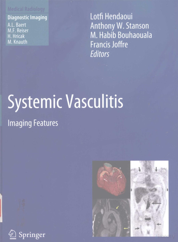 Systemic Vasculitis Imaging Featureslotfi Hendaoui 2012th Edition Anthony Wstanson