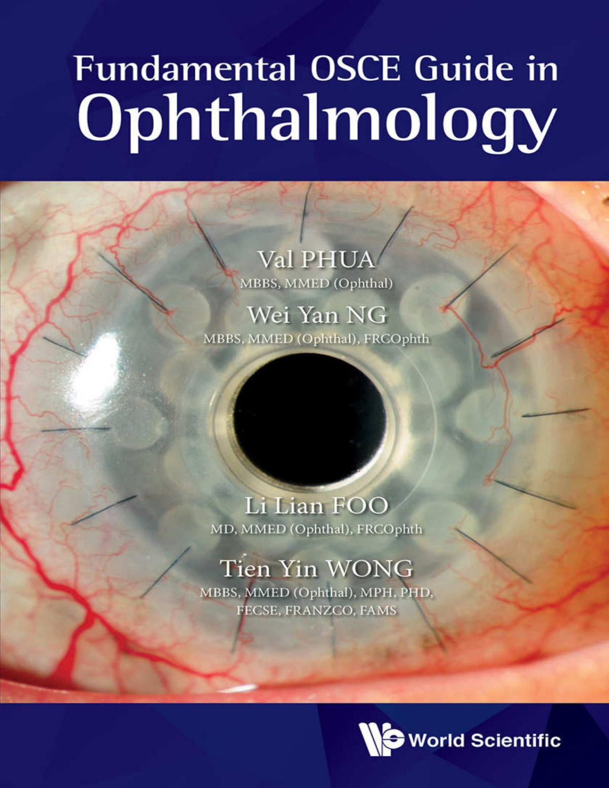 Fundamental Osce Guide In Ophthalmology Val Jun Rong Phua Wei Yan Ng Li Lian Foo Tien Yin Wong