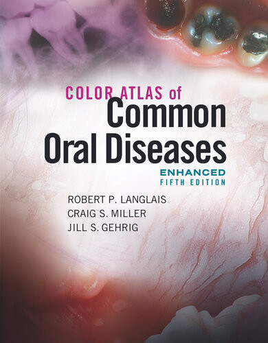 Color Atlas Of Common Oral Diseases Enhanced 5th Edition 5th Edition Robert P Langlais