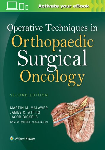 Operative Techniques In Orthopaedic Surgical Oncology 2nd Edition Jacob Bickels