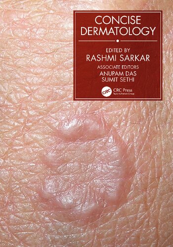 Concise Dermatology 1st Edition Rashmi Sarkar
