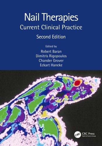 Nail Therapies Current Clinical Practice 2nd Edition Robert Baran