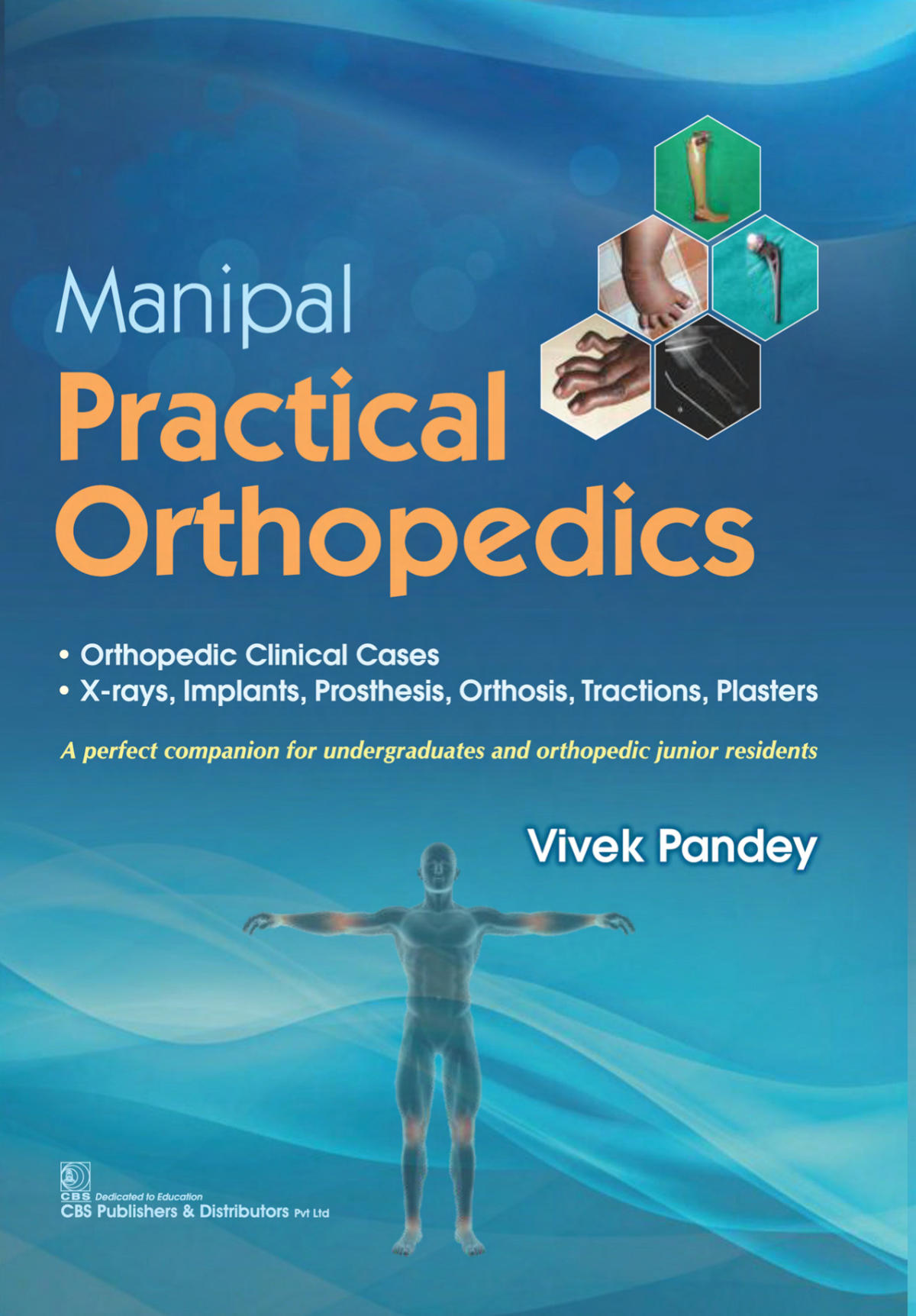 Manipal Practical Orthopedics First Edition Vivek Pandey
