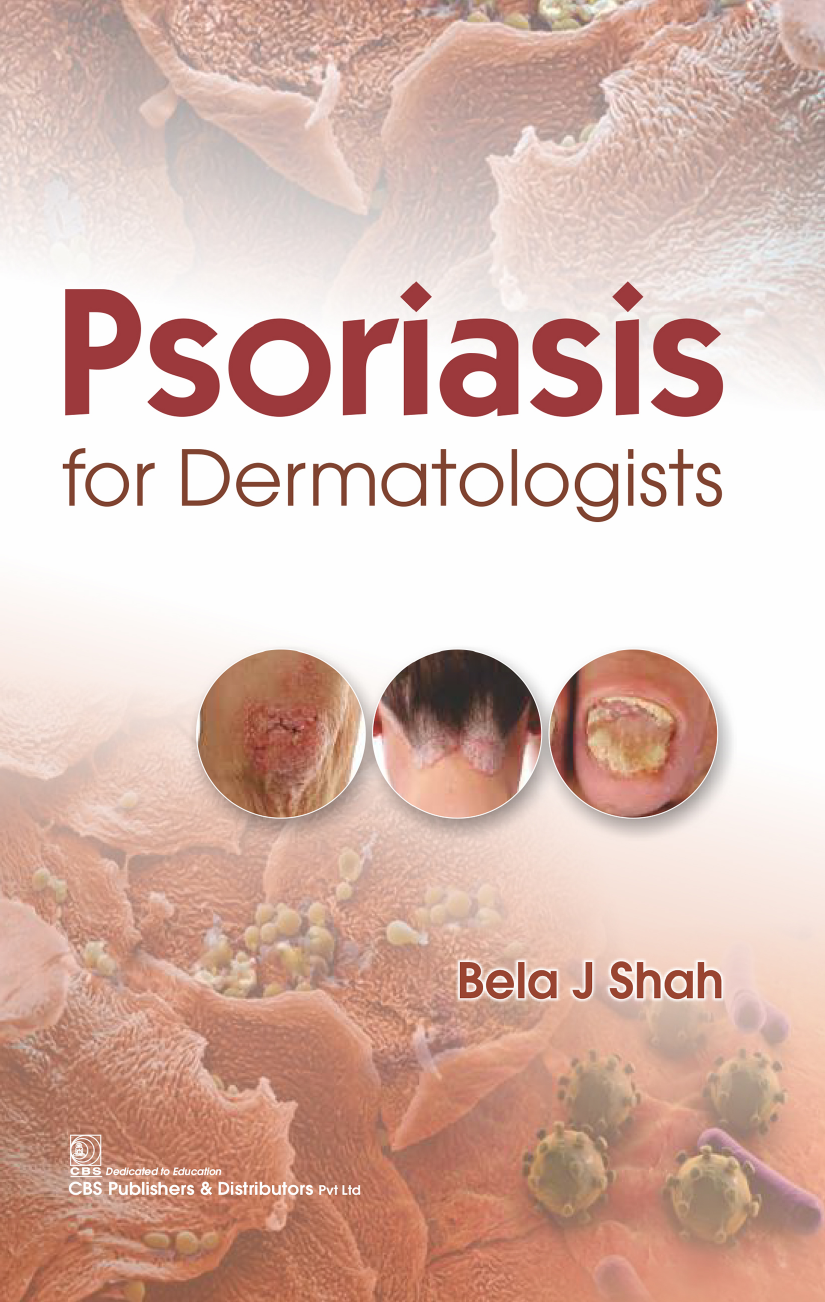 Psoriasis For Dermatologists First Edition Bela J Shah