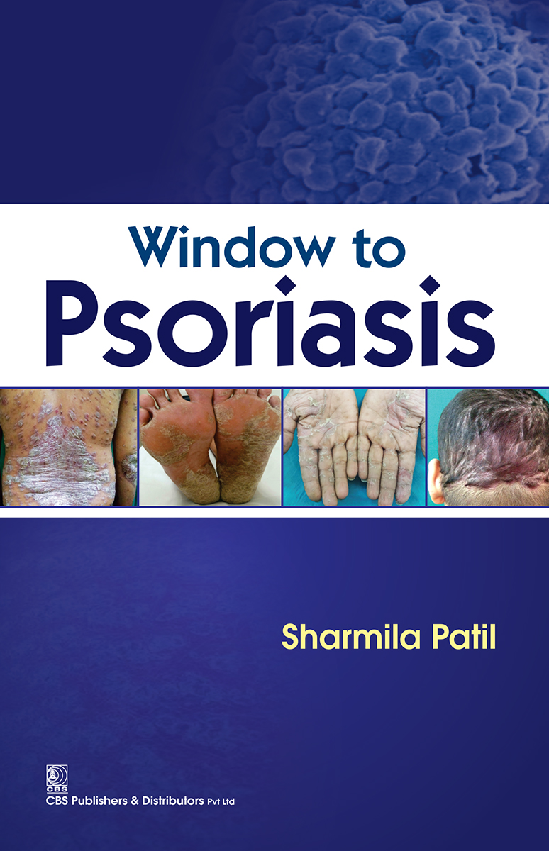 Window To Psoriasis First Edition S Patil