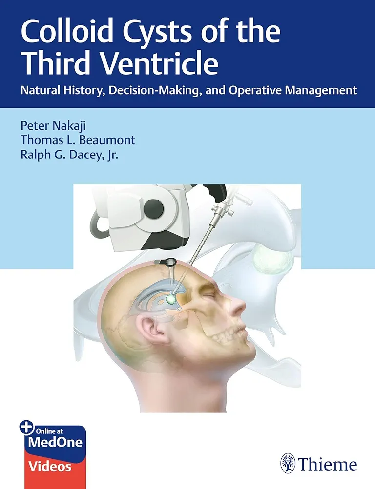 Colloid Cysts Of The Third Ventricle Natural History Decisionmaking And Operative Management Peter Nakaji