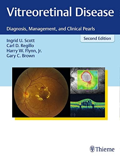 Vitreoretinal Disease Diagnosis Management And Clinidal Pearlsingrid Uscott Md Mph Carl Dregillo Md Facs Harry Wflynn Jrmd 2018th Edition Thieme