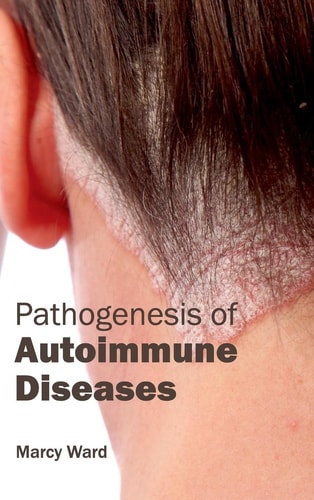 Pathogenesis Of Autoimmune Diseases 2015th Edition Marcy Ward