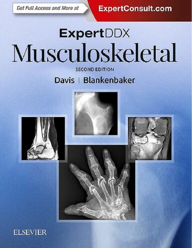Expertddx Musculoskeletal 2nd Edition Kirkland W Davis Donna G Blankenbaker