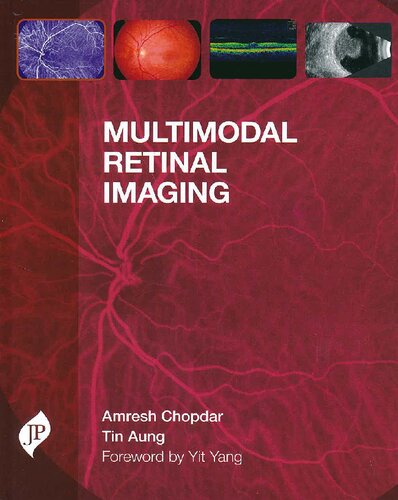 Multimodal Retinal Imaging 1st Edition Amresh Chopdar Tin Aung