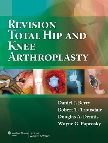 Revision Total Hip And Knee Arthroplasty 1st Edition Daniel J Berry
