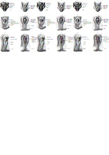 Snp Method 20 The Complete Guide To Penis Enlargement And Restoration Of Erectile Function Maverick Michael J