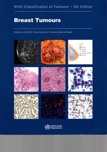 Breast Tumours Who Classification Of Tumours Medicine 5th Edition Who Classification Of Tumours Editorial Board Editor