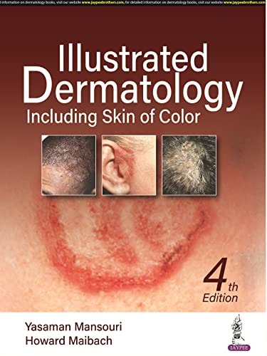 Illustrated Dermatology Including Skin Of Color Dec 1 20229354657575jaypee Brothers Medical Publisherspdf 4th Edition Yasaman Mansouri