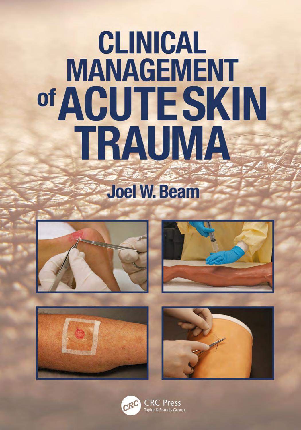 Clinical Management Of Acute Skin Trauma Joel W Beam