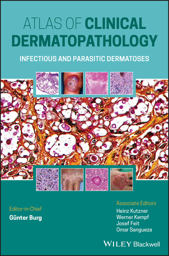 Atlas Of Clinical Dermatopathology Infectious And Parasitic Dermatoses Günter Burg