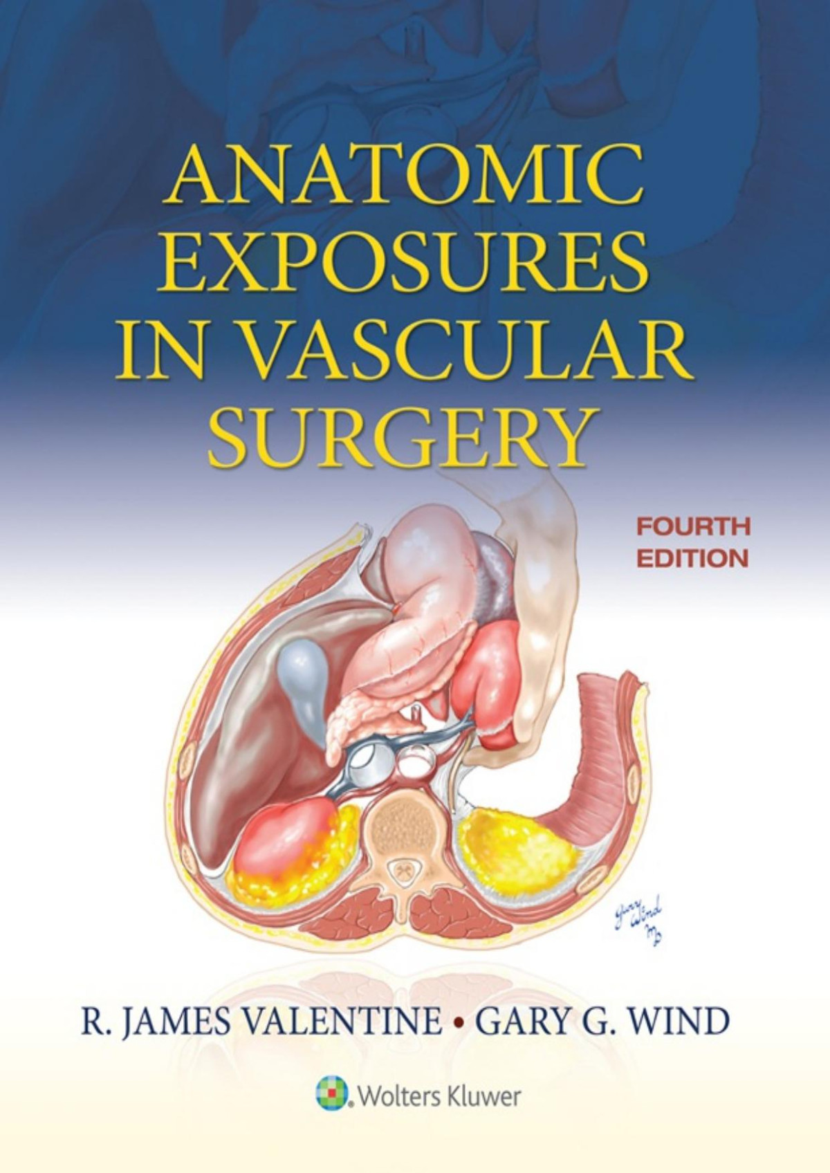 Anatomic Exposures In Vascular Surgery Fourth R James Valentine
