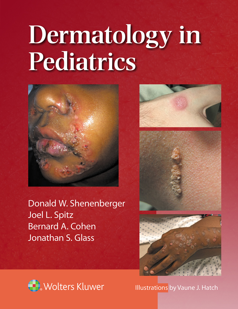 Dermatology In Pediatrics Donald W Shenenberger Joel L Spitz