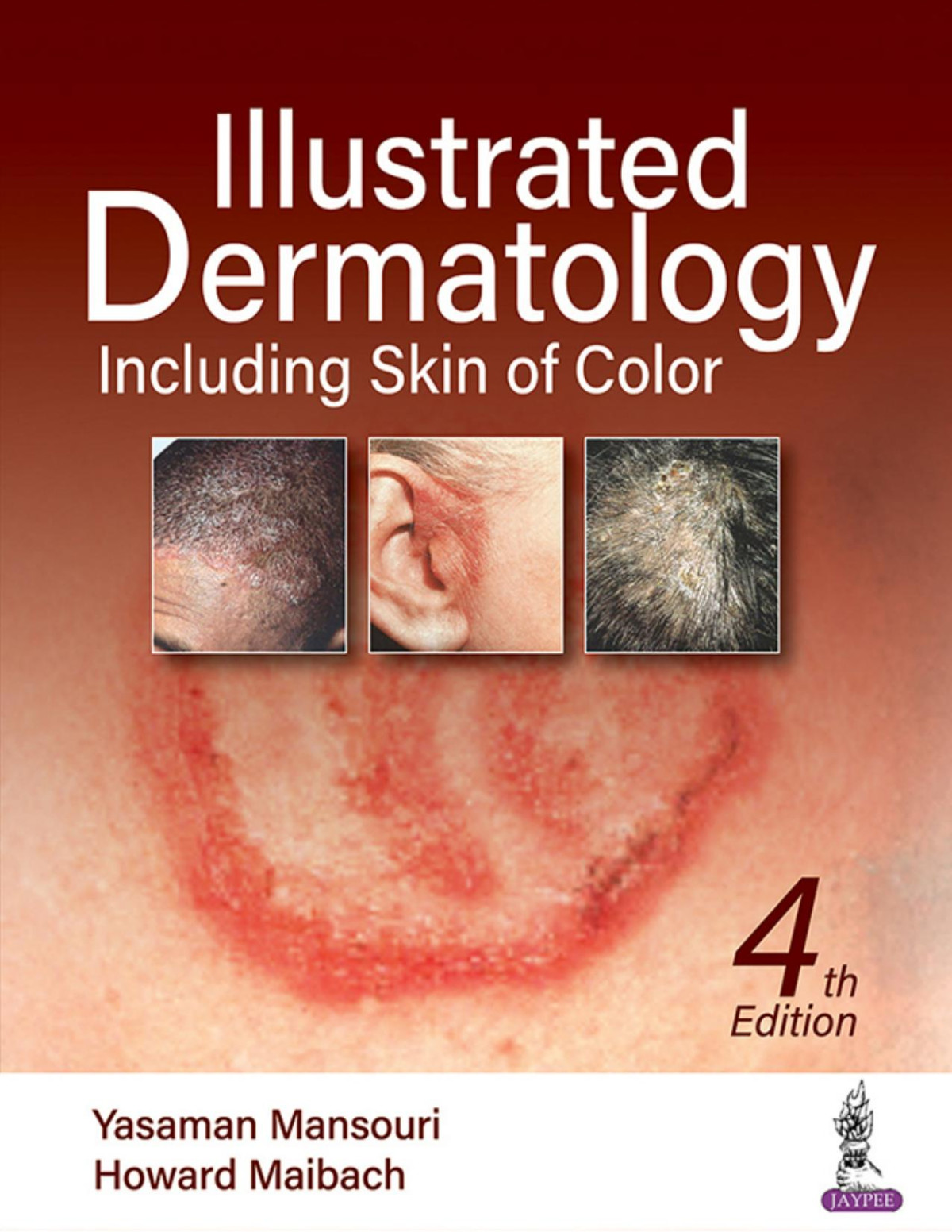 Illustrated Dermatology Including Skin Of Color Mansouri Yasamanmaibach